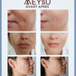 Pack jeunesse E-book et Microneedling